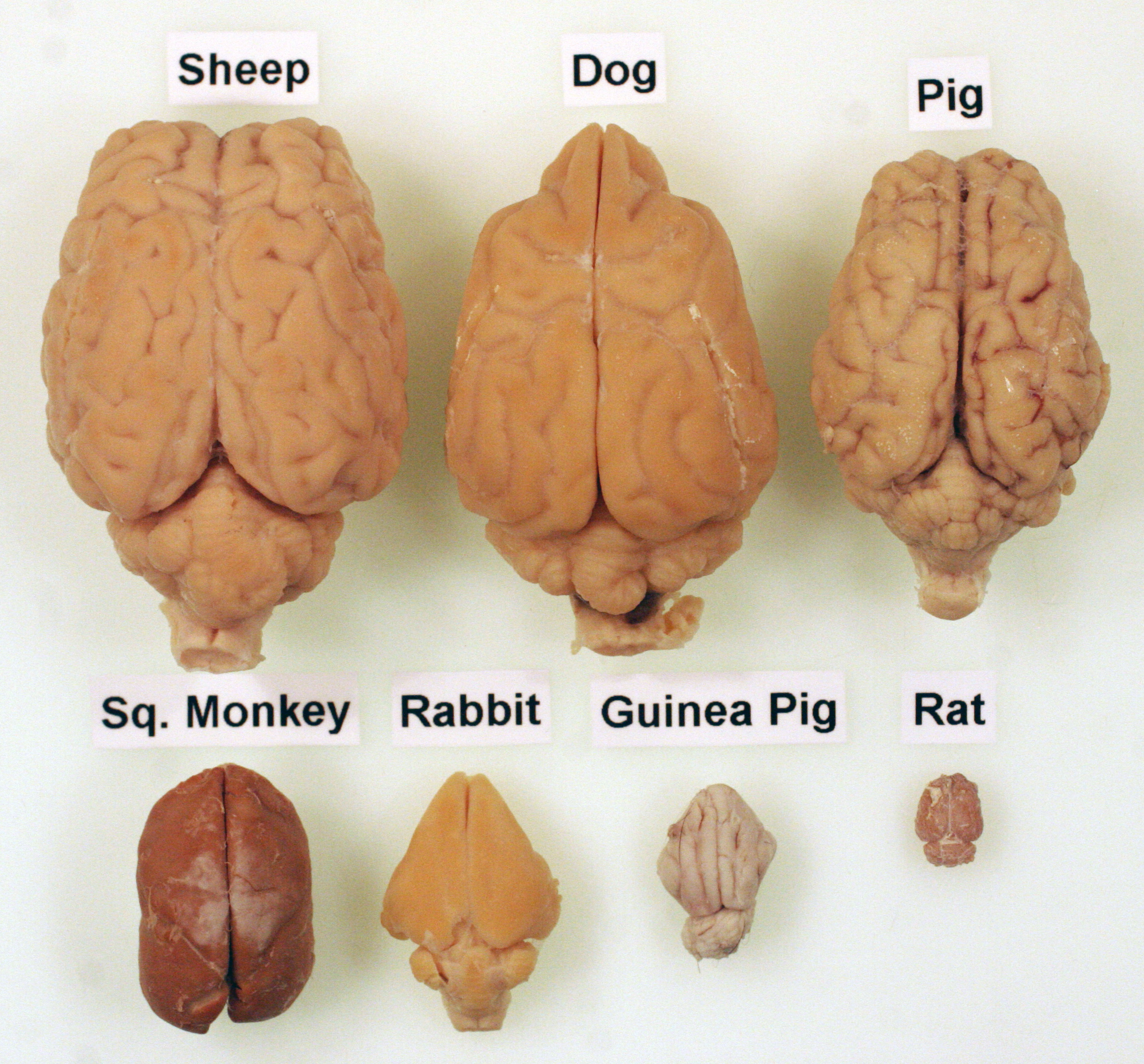 Dr B s Brain Collection Helps Local Students Learn Anatomy Scope