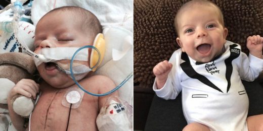 Baby with rare heart defect saved by innovative surgery