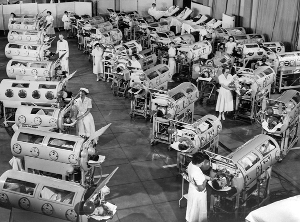 The patients in iron lungs (above) are in the auditorium of Rancho Los Amigos National Rehabilitation Center in Downey, California USA. The photograph was taken in 1953 as part of an information film produced by the March of Dimes.