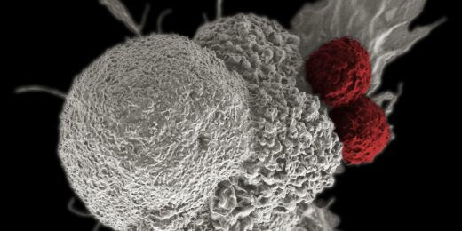 Successful immunotherapy requires a body-wide response, say Stanford researchers