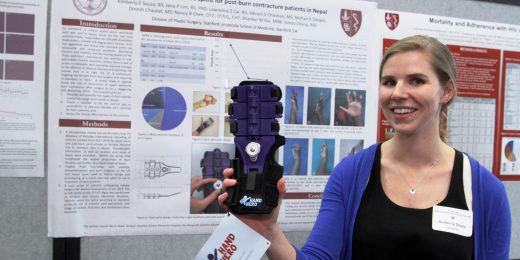 Stanford medical student helps design new device to treat burn wounds