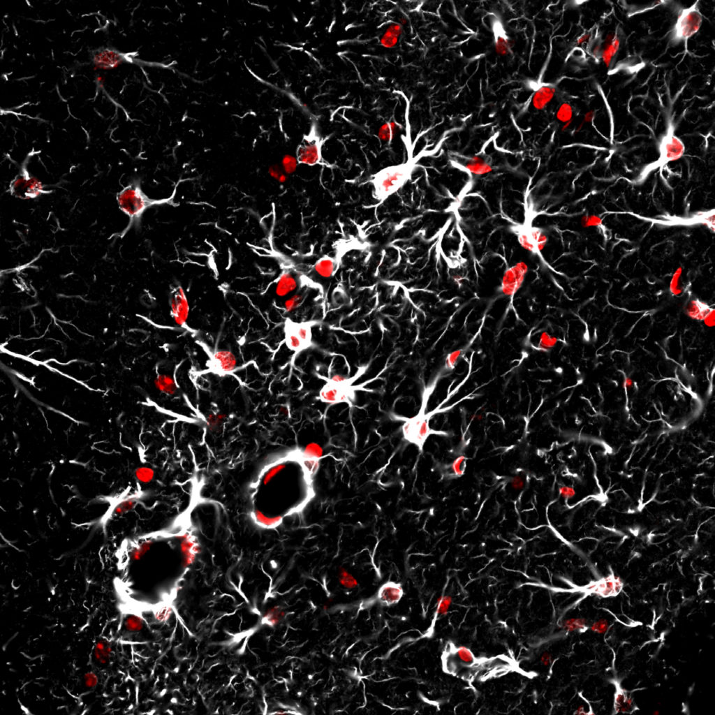 astrocytes and blood vessels