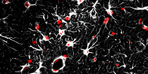 Star-shaped brain cells called astrocytes implicated in brain’s aging process, Stanford study shows