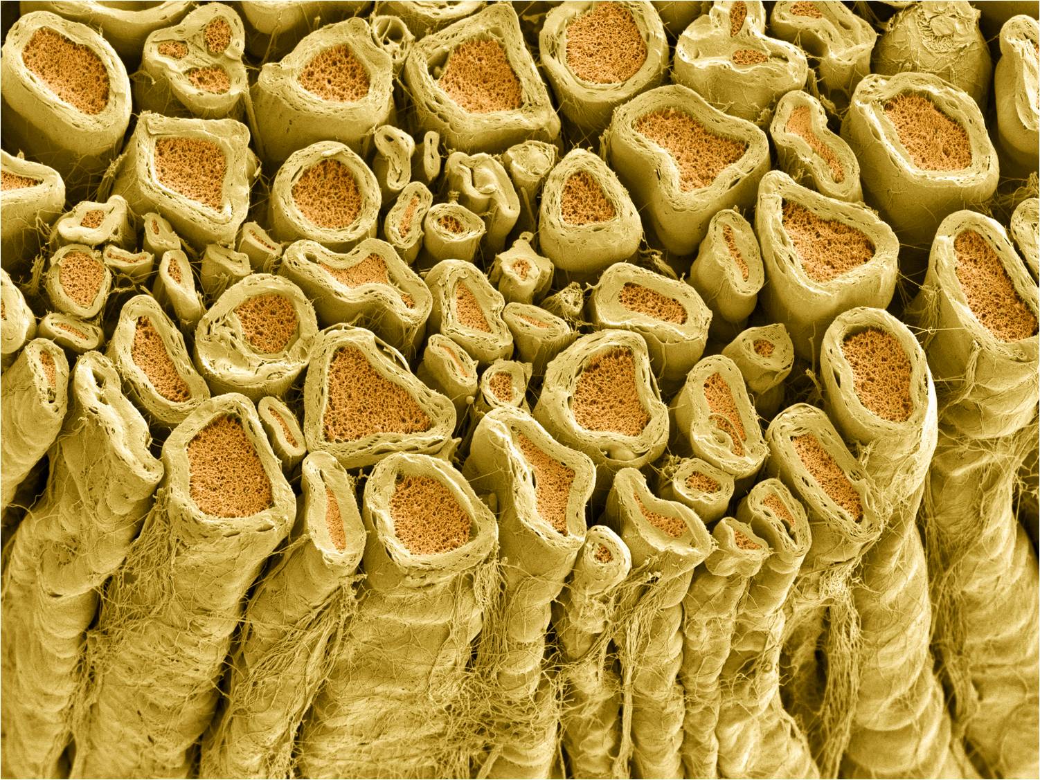 Axons covered with myelin