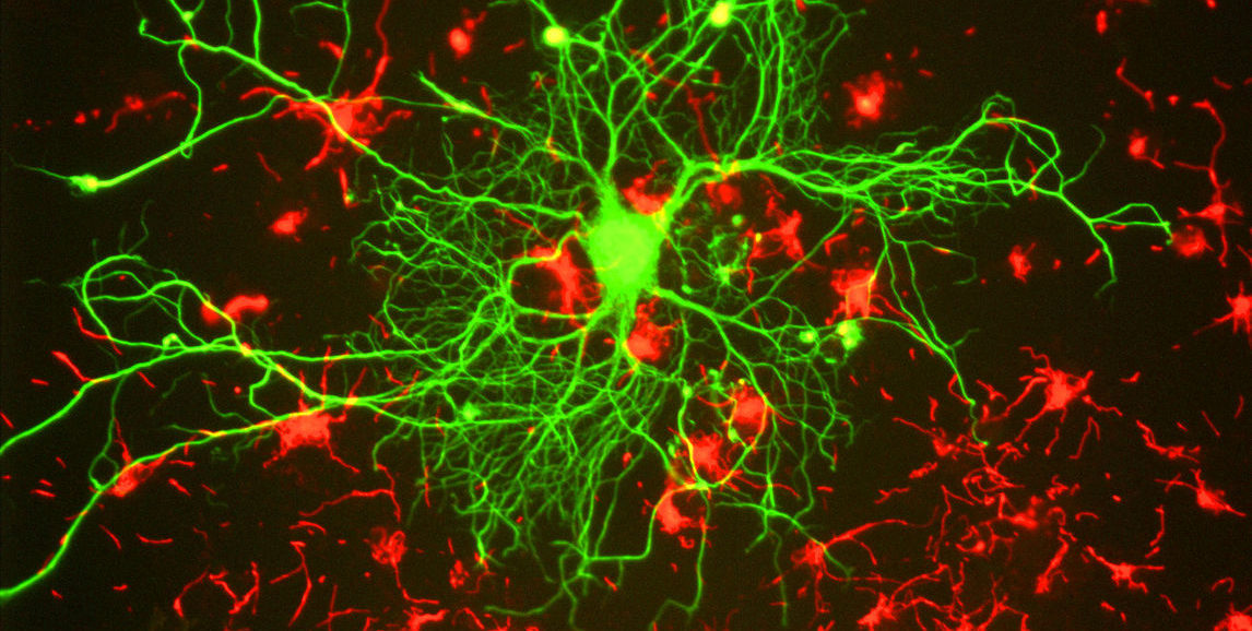neuron in green