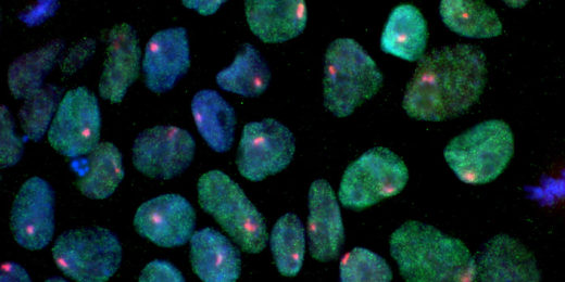 Peering into reprogramming’s black box, Stanford researchers ID critical stem cell creation protein
