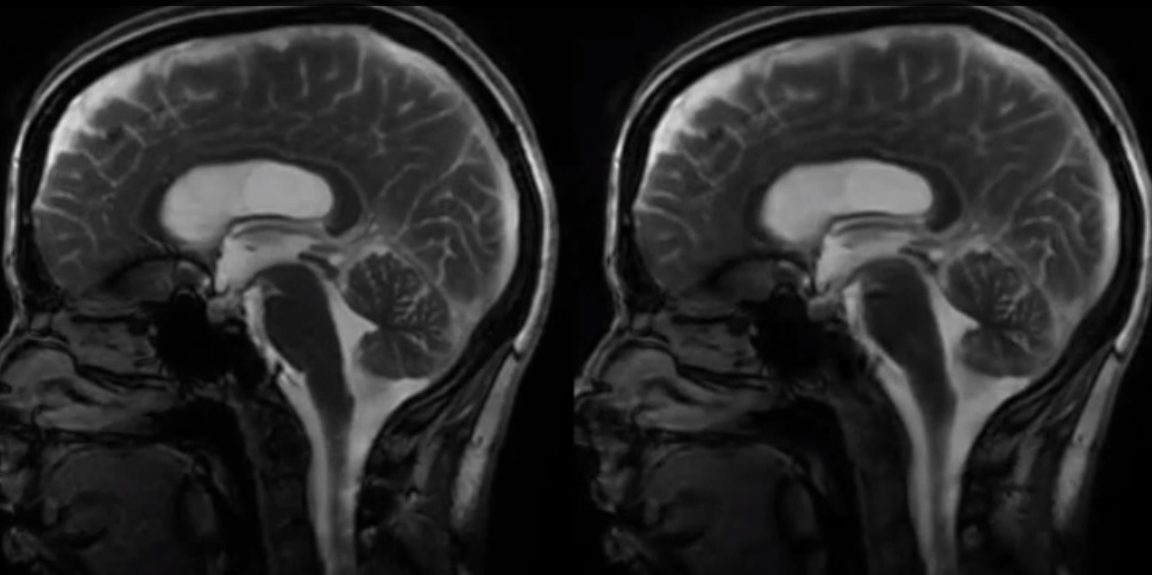 The beating brain: A video captures the organ's rhythmic