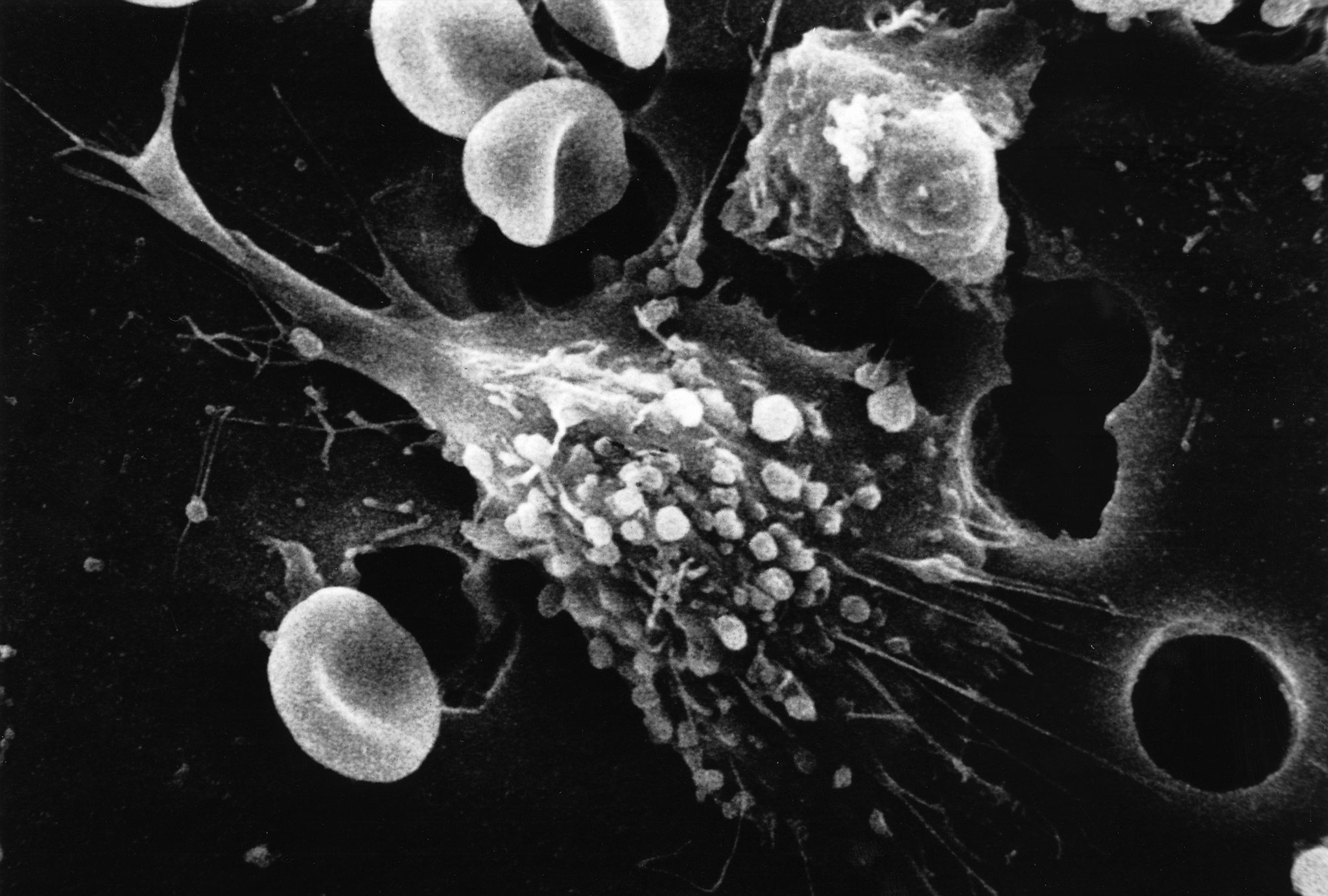 cancer cells dying