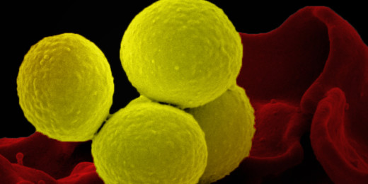 A new strategy for combatting antibiotic-resistant infections