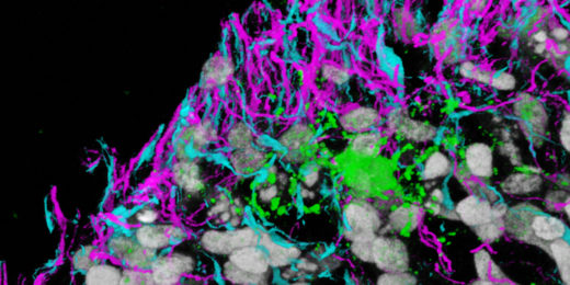 Culturing technique captures hard-to-study, critically important brain cell — the oligodendrocyte — in action