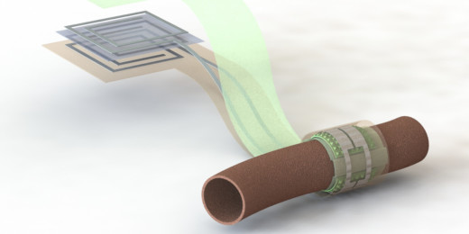 This sensor can monitor blood flow – then disappear