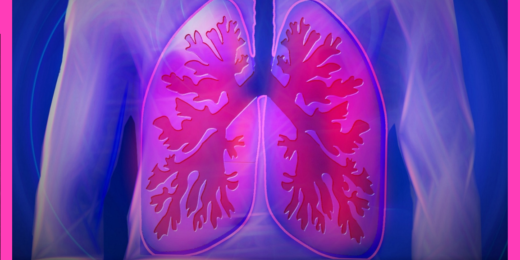 Blood test may detect early signs of lung-transplant rejection