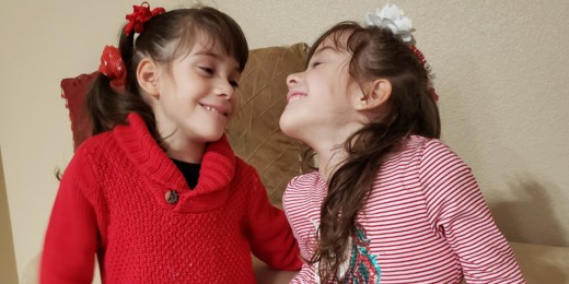 Formerly conjoined twins separated at Packard Children’s are doing well