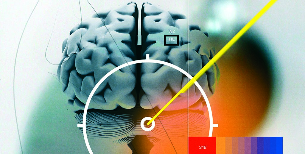 illustration of brain and laser