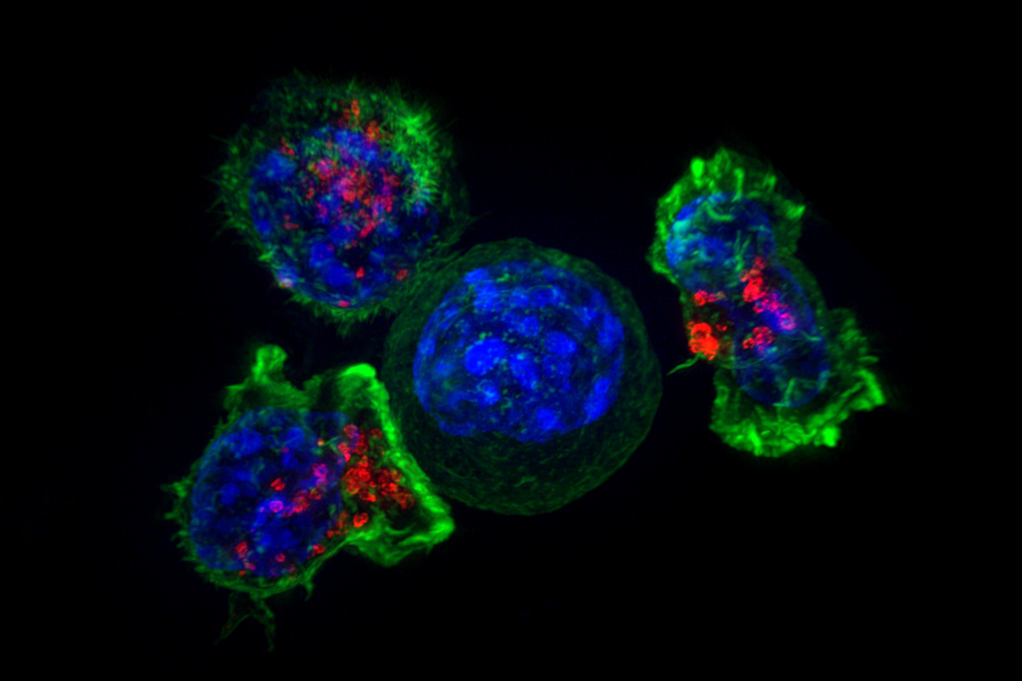 killer t cell vs cancer