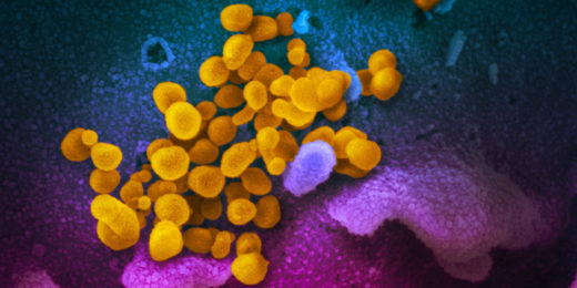 How remdesivir works, and why it’s not the ultimate coronavirus killer