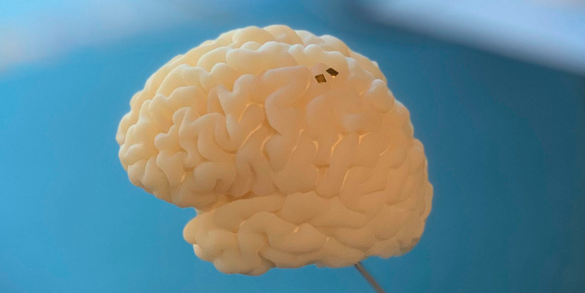 neural implants like those shown on this 3D printed brain use wires to transmit information and receive power