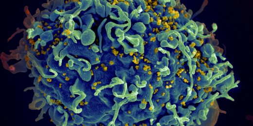 Enlisting the entire immune system strengthens potency of HIV vaccines in development