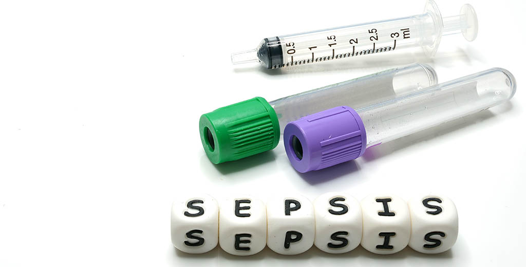 Sepsis research