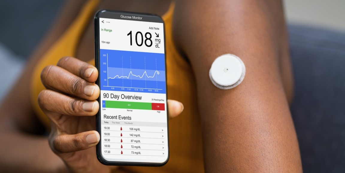 image of woman holding continuous glucose monitor
