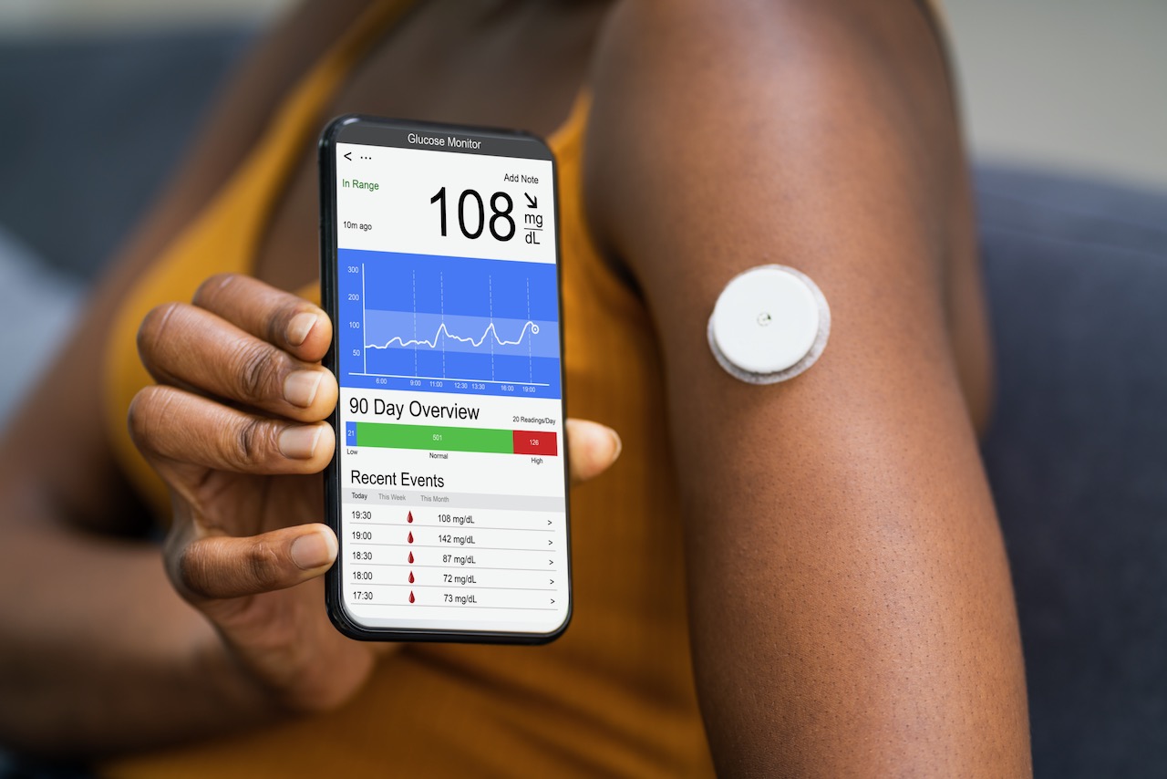 cent kool Tijd Continuous,Glucose,Monitor,Blood,Sugar,Test,Smart,Phone,App - Scope