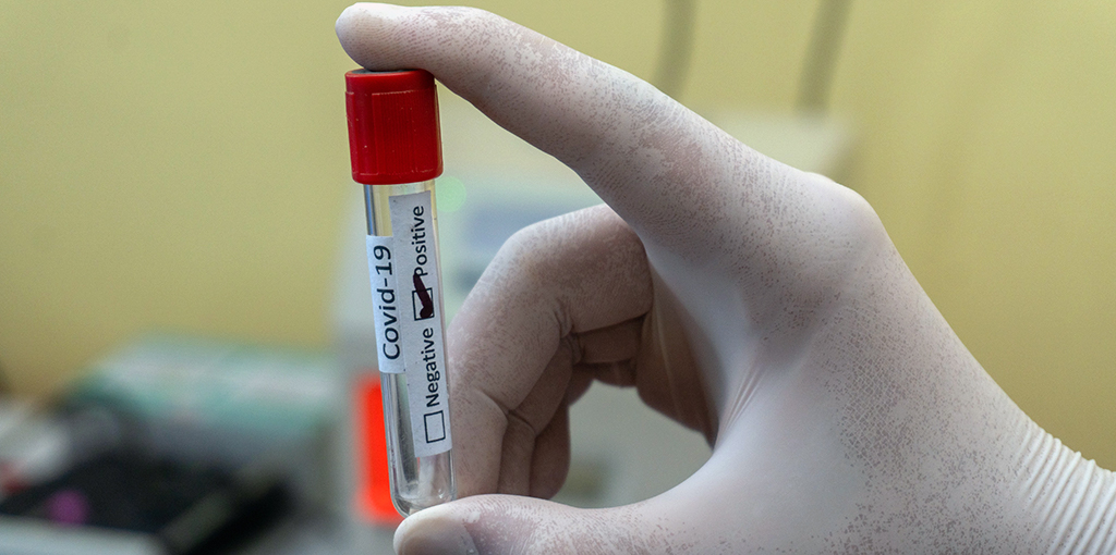 A hand holds an empty vial labeled COVID-19 positive.