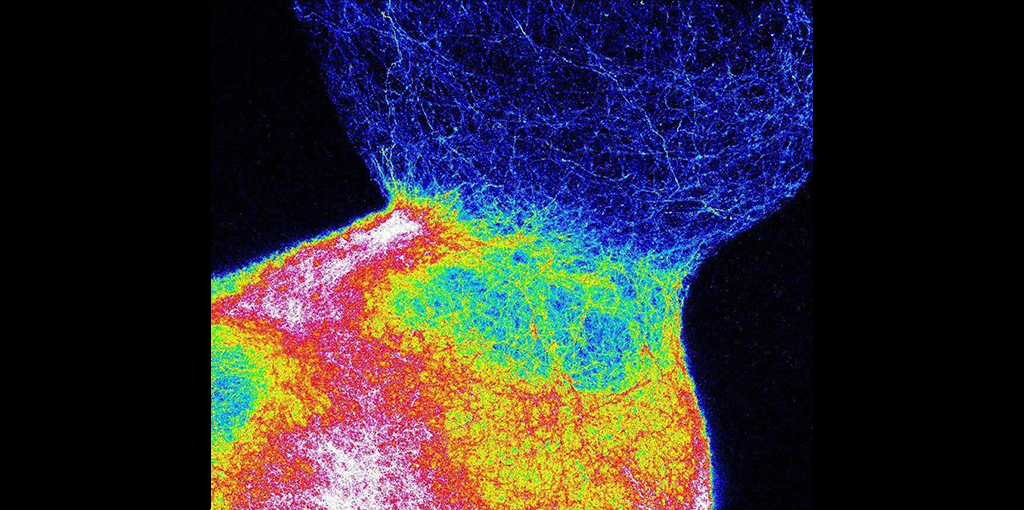 Stanford neuroscientist's 'assembloids' pave the way for innovative brain research