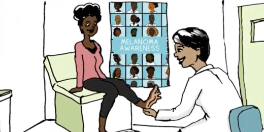 Researchers discuss health disparities in melanoma diagnoses