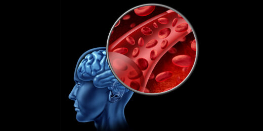 Blood condition linked to protection against Alzheimer’s