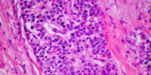 New AI tool for pathologists trained by Twitter (now known as X)